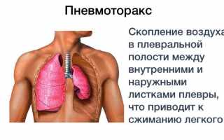 Что делать, если мучает одышка при бронхите?