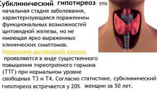 Гипотиреоз щитовидной железы
