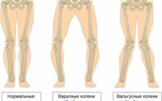 Здоровые суставы — профилактика и лечение
