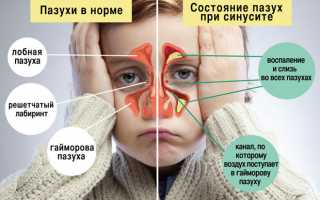 Температура при гайморите: сколько держится и какая может быть