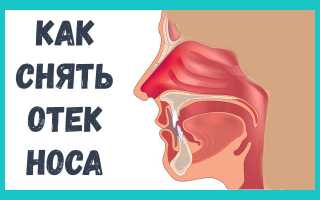 Как быстро снять отек слизистой носа в домашних условиях?