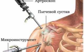 Здоровые суставы — профилактика и лечение