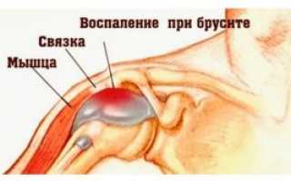 Здоровые суставы — профилактика и лечение