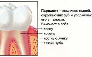 Пародонтит – лечение заболевание разными методами