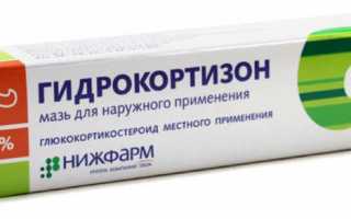 У ребенка слезятся глаза и насморк, что делать?