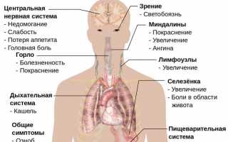 Долго болит горло и не проходит (без температуры): причины и лечение