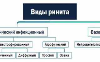 Задний ринит: правильное лечение