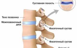 Здоровые суставы — профилактика и лечение