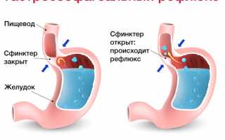 Кашель у ребенка без температуры и соплей: чем лечить, причины возникновения