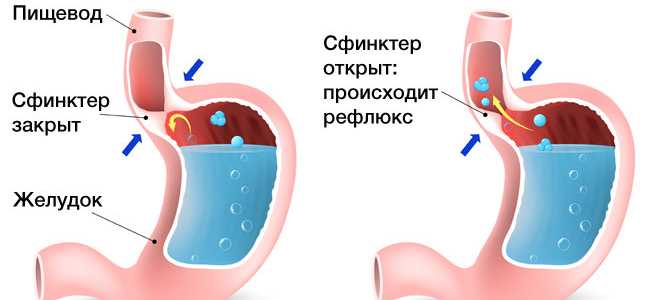 Кашель у ребенка без температуры и соплей: чем лечить, причины возникновения